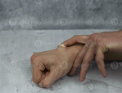 Applying ointment on the hematoma. Hematoma treatment. 27840523 Stock Photo at Vecteezy