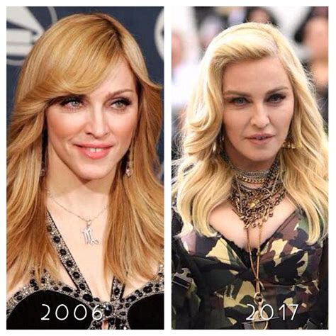 Question: Does Madonna look better with or without facial and cheek ...