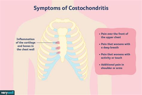 Costochondritis: Causes, Cures, and More