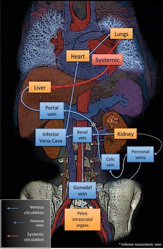 Metastatic Renal Cell Carcinoma: Radiologic Findings and Assessment of ...