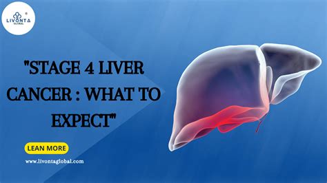 "Stage 4 Liver Cancer : What to Expect" - Livonta Global Pvt Ltd