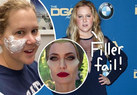 Amy Schumer Got Botched Plastic Surgery & IMMEDIATELY Undid It: 'I Looked Like Maleficent ...