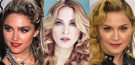 Madonna Plastic Surgery Before and After Pictures 2024