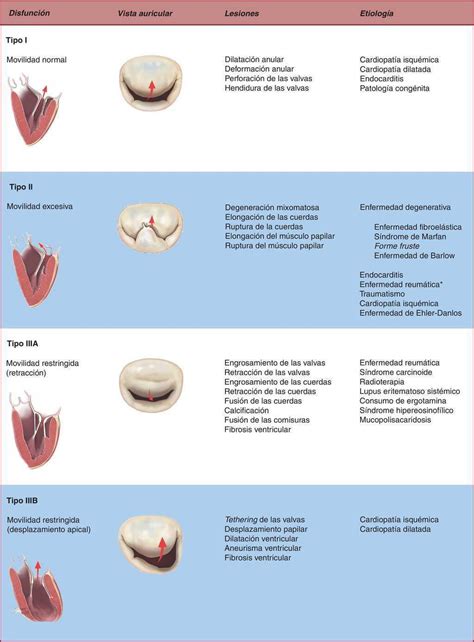 Ecocardiografía quirúrgica de la válvula mitral | Revista Española de Cardiología