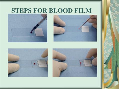 PPT - Blood smear preparation and staining PowerPoint Presentation - ID ...