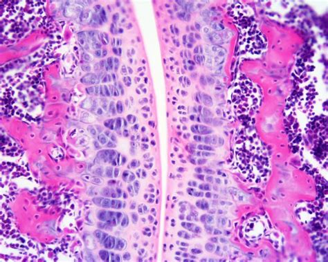 File:Cartilage histology 005.jpg - Embryology