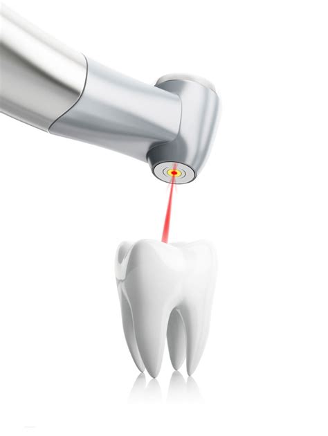 Detect and Treat Cavities with Laser Dentistry - Hardy Pediatric Dentistry & Orthodontics