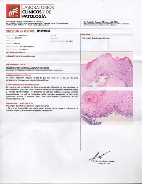 Biopsy Report: Common Old Man Skin Cancer - Retired in Costa Rica