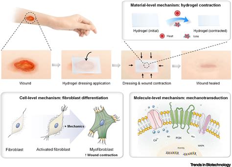 Hydrogel-enabled mechanically active wound dressings: Trends in ...