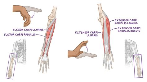 Joints of the wrist and hand: Video & Anatomy | Osmosis