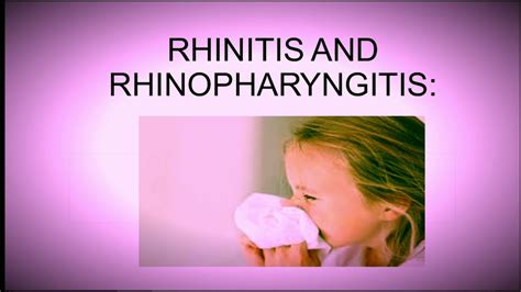 Rhinitis and Rhinopharyngitis pedatrics - YouTube