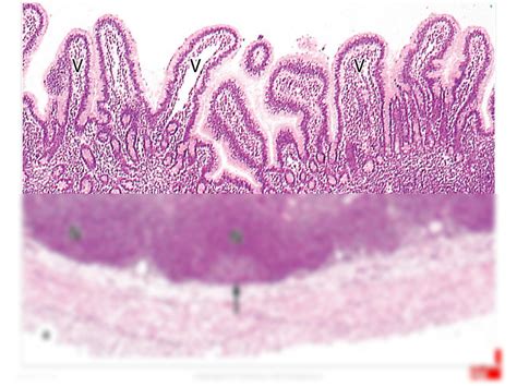 SOLUTION: lymphoid tissue histology - Studypool