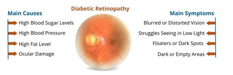 Diabetic Retinopathy Treatment in Delhi with Causes and Stages