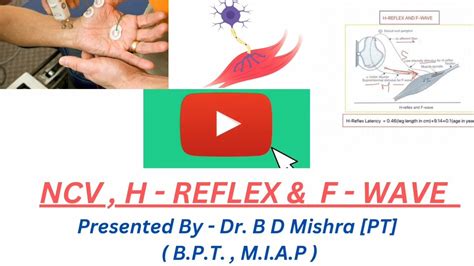 What is the normal nerve conduction velocity?What does the H-reflex & F wave in nerve conduction ...