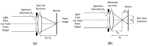 (a) Optical ray diagrams for an eye lens system having a normal eye ...