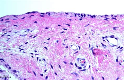 Synovial Membrane Histology