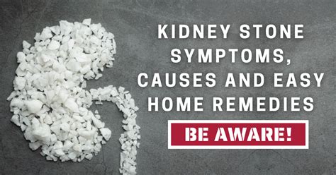 Kidney Stone Symptoms, Causes and Easy Home Remedies