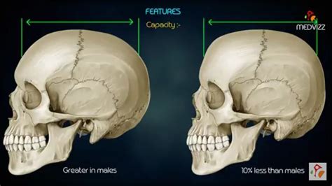 Male x female skull | Medical, Skull, Medical education