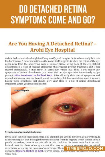 Do detached retina symptoms come and go? - TimesMojo