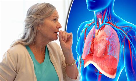 Cryptococcosis: Cough and chest pain could be sign of deadly infection | Express.co.uk