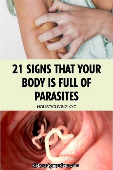 21 Signs That Your Body is Full of Parasites | Parasite, Intestinal ...