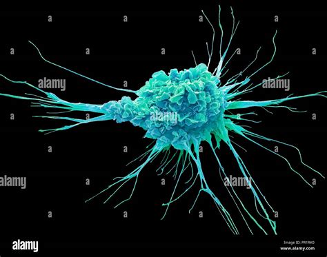 Dendritic cell. Coloured scanning electron micrograph (SEM) of a ...