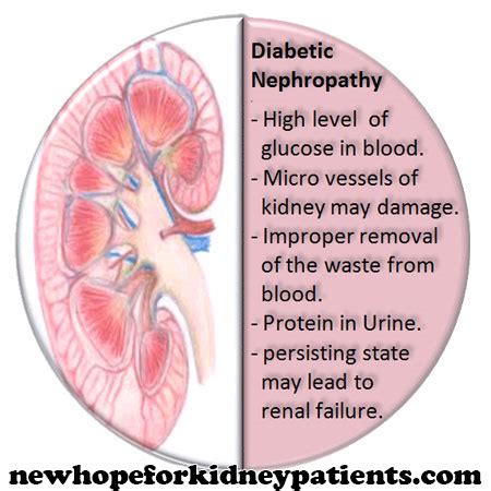 NHFKP | A new hope for kidney patients!