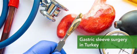 Gastric Sleeve Surgery Turkey Prices | Sleeve Gastrectomy Cost in Turkey