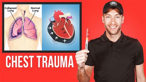 EASY Guide for CHEST TRAUMA - YouTube