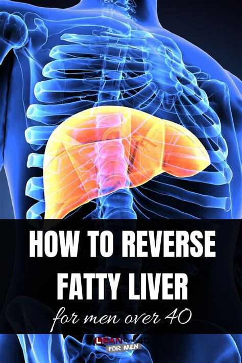 How to Reverse Fatty Liver | Fatty liver, Fatty liver diet, Fatty liver diet recipes