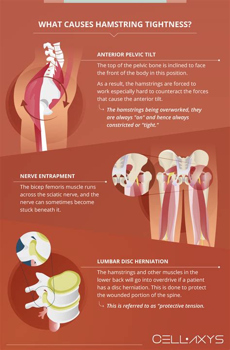 Knee Pain: Can Tight Hamstrings Cause Knee Pain? - Cellaxys