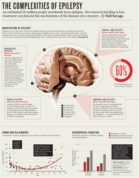 Epidemiology: The complexities of epilepsy | Nature