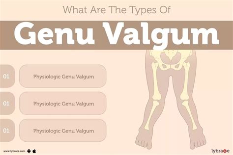 Genu Valgum: Causes, Symptoms, Treatment and Cost