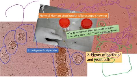 Stool under Microscope - YouTube