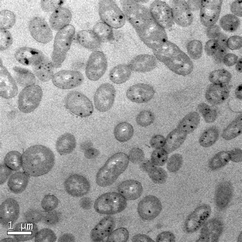 Prevalence of heterotrophic methylmercury-detoxifying bacteria across ...