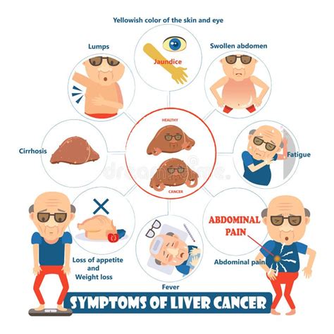 Liver Cancer Diagram