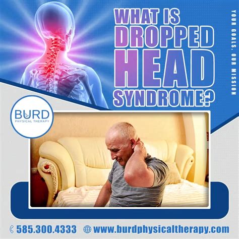 Dropped Head Syndrome | Dropped Head Syndrome is characterized by ...