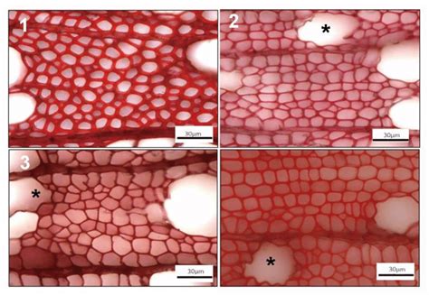 9 Light microscopy images of safranin dyed stem cross sections ...