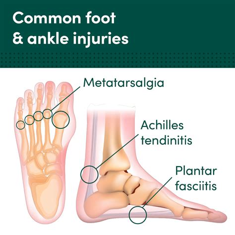 Avoid these foot and ankle injuries while cycling