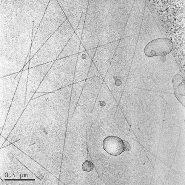 Cryo-TEM-micrograph of the sample of Figure 6 showing vesicles ...