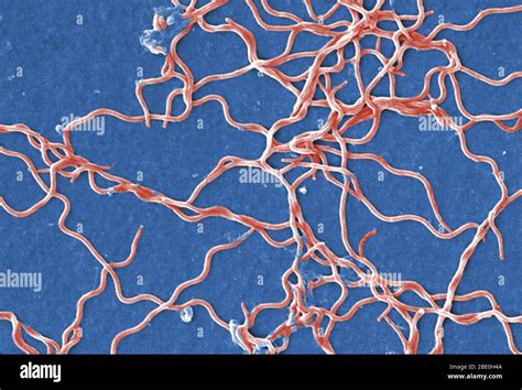 Lyme disease spirochetes hi-res stock photography and images - Alamy