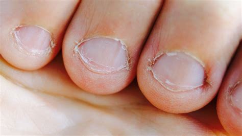 How to Stop Biting Your Nails? Read This! | ThatSweetGift