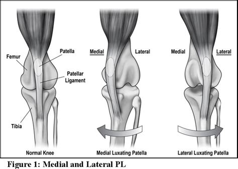 Table 1 from Systematic review of patellar luxation in dogs | Semantic Scholar