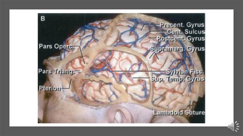 SOLUTION: Neuroradiology and anatomy pptx - Studypool