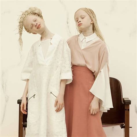 Lara And Mara The Albino Twin Models From Brazil Are The Talk Of The ...