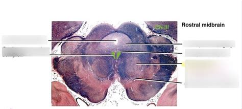 rostral midbrain Diagram | Quizlet