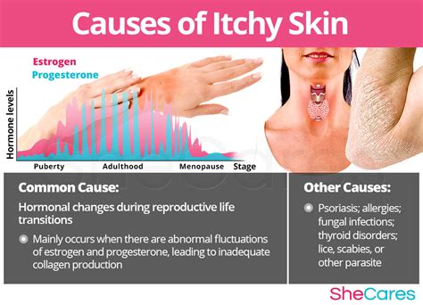 Dry and Itchy Skin | SheCares