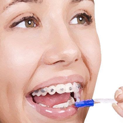 What's the best Electric Toothbrush for Braces? | Brushing teeth ...