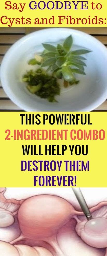 Say GOODBYE to Cysts and Fibroids: This Powerful 2-Ingredient Combo ...