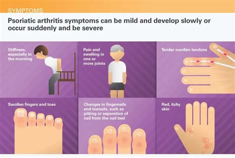 Arthritis: 7 most painful types of arthritis- cause, symptoms, treatments